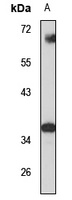 PPA2 Rabbit Polyclonal Antibody