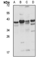 PAP-2b Rabbit Polyclonal Antibody