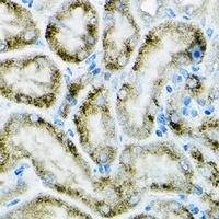 PGC1 alpha Antibody