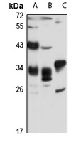 PP6 Rabbit Polyclonal Antibody