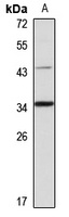 PPT2 Rabbit Polyclonal Antibody