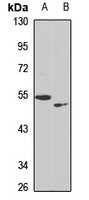 PRAMEF20/21 Rabbit Polyclonal Antibody