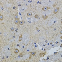 PRAMEF20/21 Rabbit Polyclonal Antibody