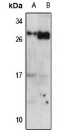 PRAP1 Rabbit Polyclonal Antibody