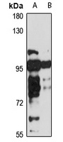 PRDM1 Rabbit Polyclonal Antibody
