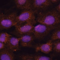 PRKRIP1 Antibody