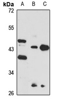 PRMT1 Rabbit Polyclonal Antibody