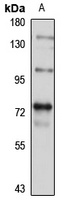 PRMT9 Rabbit Polyclonal Antibody