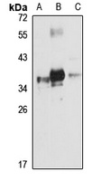 PRPS2 Rabbit Polyclonal Antibody