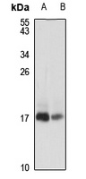 PEN-2 Rabbit Polyclonal Antibody