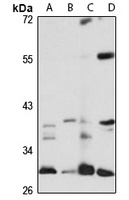 PSMB7 Rabbit Polyclonal Antibody