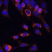 PSMB7 Rabbit Polyclonal Antibody