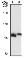 PSMD1 Antibody