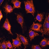PTCD1 Rabbit Polyclonal Antibody