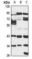 PTGR1 Rabbit Polyclonal Antibody