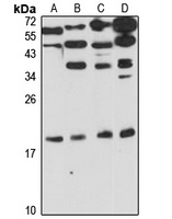 PRL2 Rabbit Polyclonal Antibody