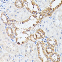 PRL2 Rabbit Polyclonal Antibody