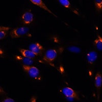 PRL2 Rabbit Polyclonal Antibody