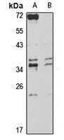 PURA Rabbit Polyclonal Antibody
