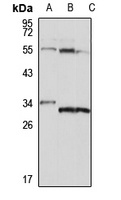 PYCR2 Rabbit Polyclonal Antibody