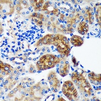 PYCR2 Rabbit Polyclonal Antibody