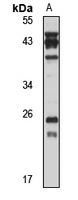 RAB28 Rabbit Polyclonal Antibody