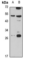 RAB34 Rabbit Polyclonal Antibody