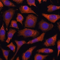 RABGGTA Rabbit Polyclonal Antibody