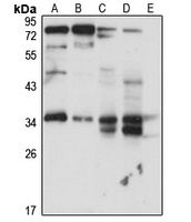 RABGGTB Rabbit Polyclonal Antibody