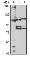 EPAC2 Rabbit Polyclonal Antibody