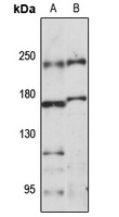 RB1CC1 Rabbit Polyclonal Antibody