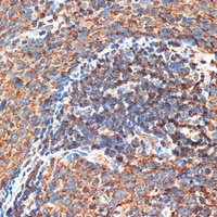 RB1CC1 Rabbit Polyclonal Antibody