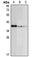 RBM11 Rabbit Polyclonal Antibody