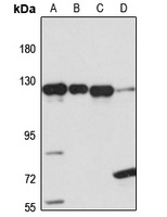 RBM25 Rabbit Polyclonal Antibody
