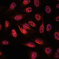 RBM25 Rabbit Polyclonal Antibody