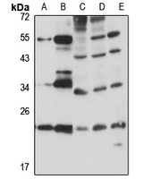 RBM8A Rabbit Polyclonal Antibody