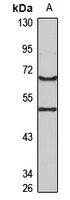 REC8 Rabbit Polyclonal Antibody