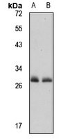 REXO2 Rabbit Polyclonal Antibody