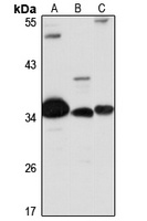 RHBDD1 Rabbit Polyclonal Antibody