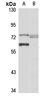 RHOBTB1 Rabbit Polyclonal Antibody