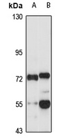 RMI1 Rabbit Polyclonal Antibody
