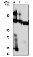 RNF20 Rabbit Polyclonal Antibody