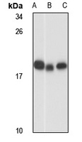 RPL18A Rabbit Polyclonal Antibody