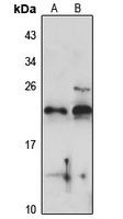 RPL24 Rabbit Polyclonal Antibody
