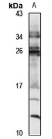 Ribosomal Protein L36a Rabbit Polyclonal Antibody