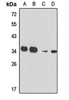 RPL7A Rabbit Polyclonal Antibody