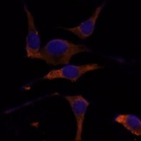 RPL7A Rabbit Polyclonal Antibody