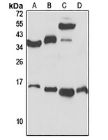 RPS25 Rabbit Polyclonal Antibody
