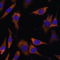 RPS25 Rabbit Polyclonal Antibody