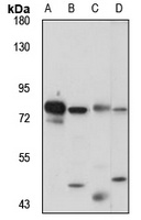 RPS6KA2 Antibody